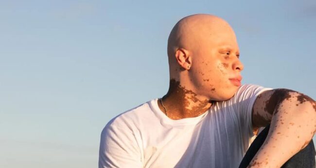 man looking toward setting sun