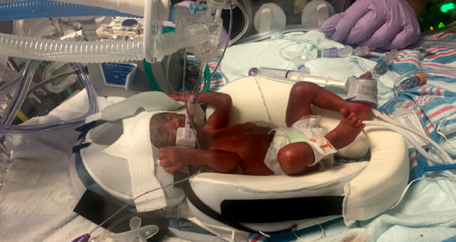 Zion NICU